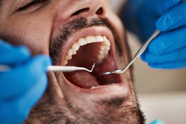 Best Mobile Emergency Dentist in Ballard, UT